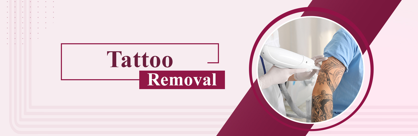 Tattoo Removal  Hair Wigs Services