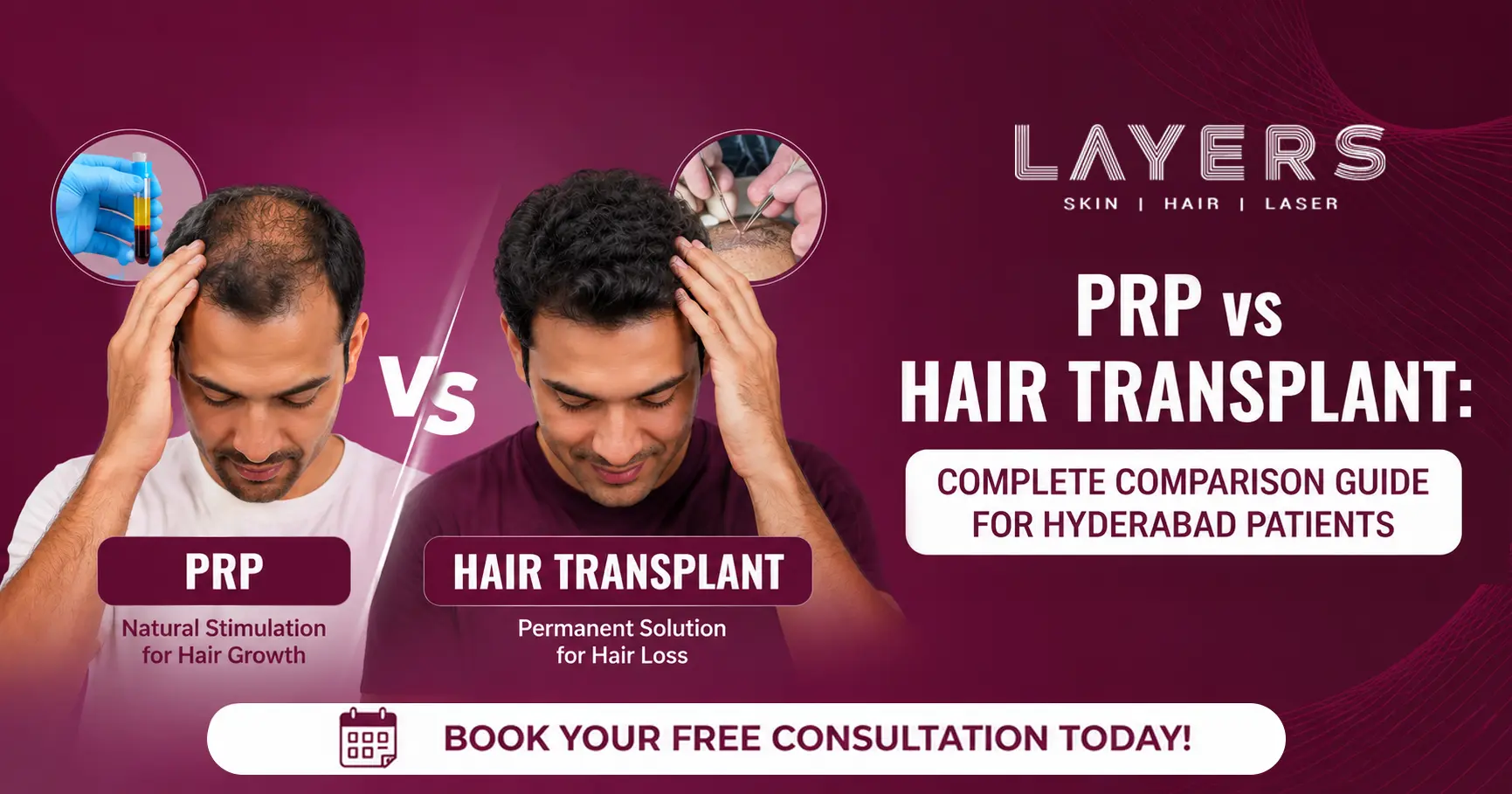 PRP vs Hair Transplant: Which is Better? Complete Comparison