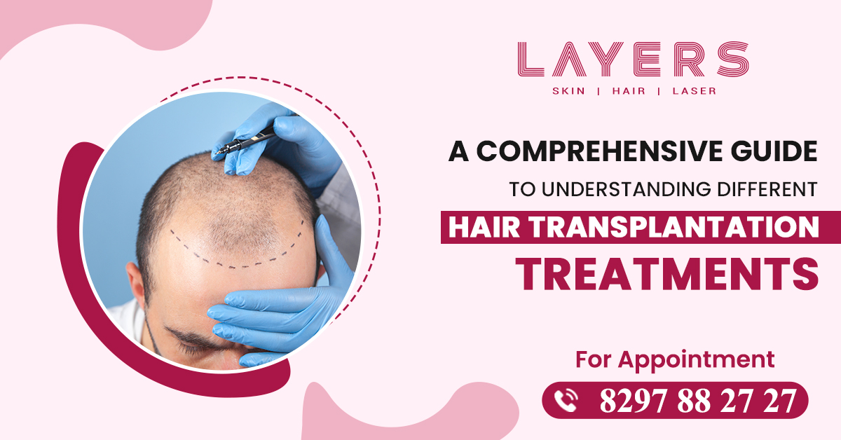types of hair transplant techniques