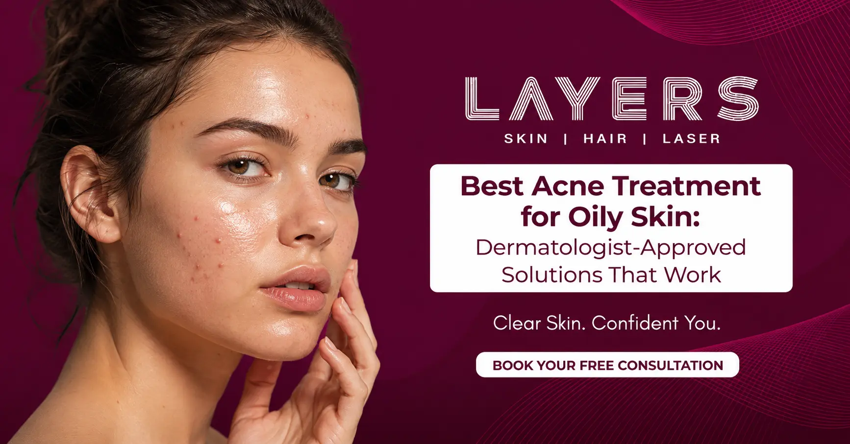 Best Acne Treatment for Oily Skin