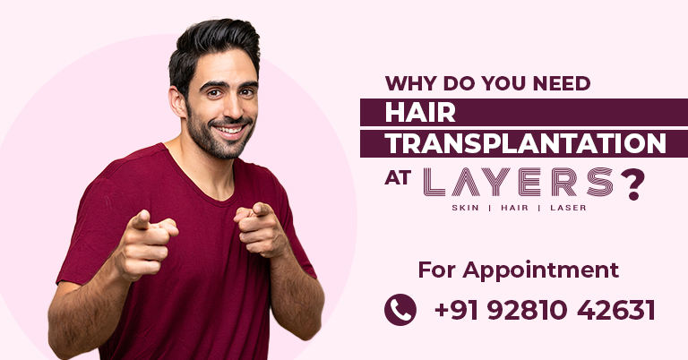 hair transplantation in hyderabad