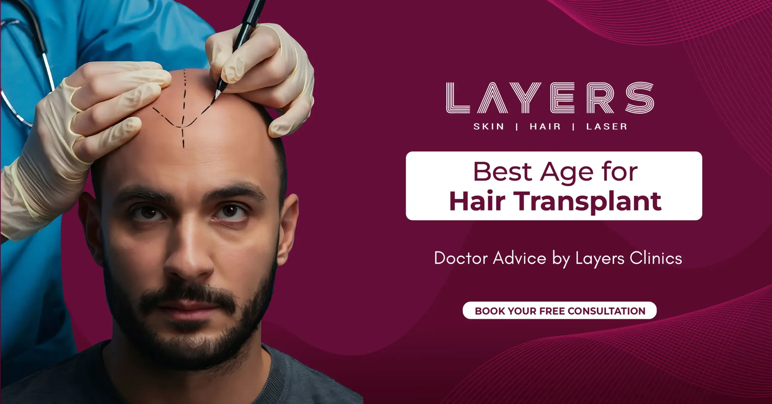 Best Age for Hair Transplant