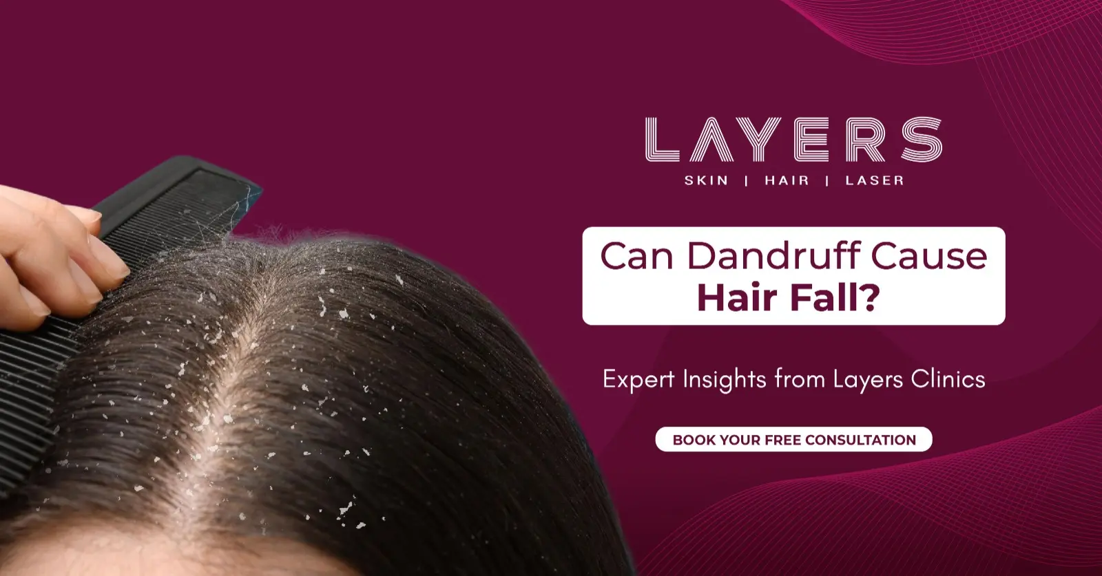 Can Dandruff Cause Hair Fall