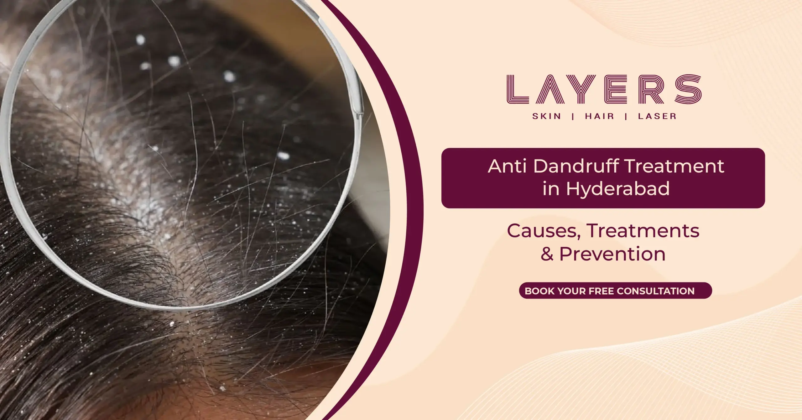 Anti Dandruff Treatment in Hyderabad