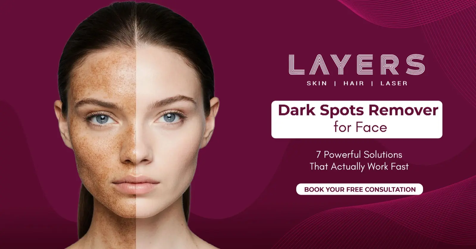 Dark Spot Remover for Face