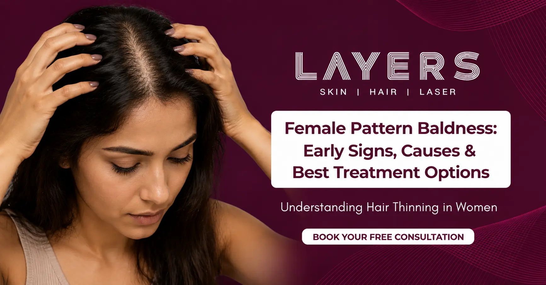 Female Pattern Baldness Early Signs