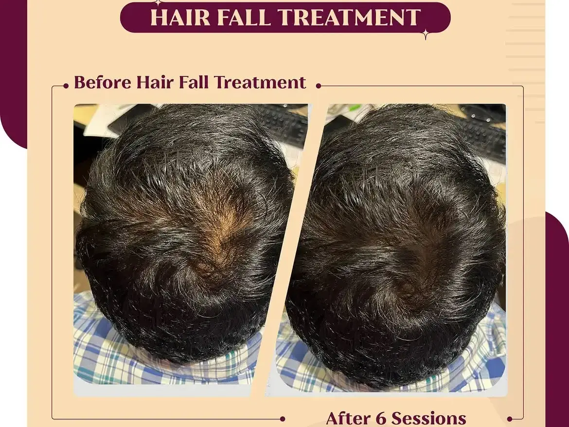 Hair thinning or low volume can affect both your confidence and appearance, but the right treatm (1)
