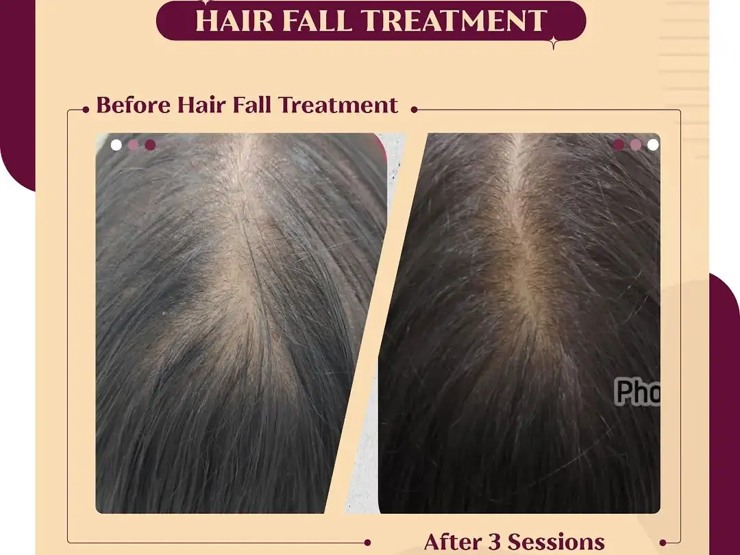 Hair thinning or low volume can affect both your confidence and appearance, but the right treatm