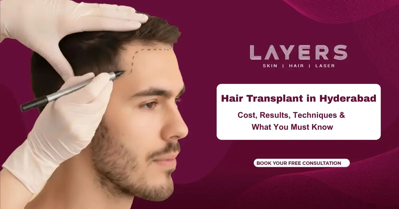 Hair Transplant in Hyderabad: Cost, Results, Techniques & What You Must Know