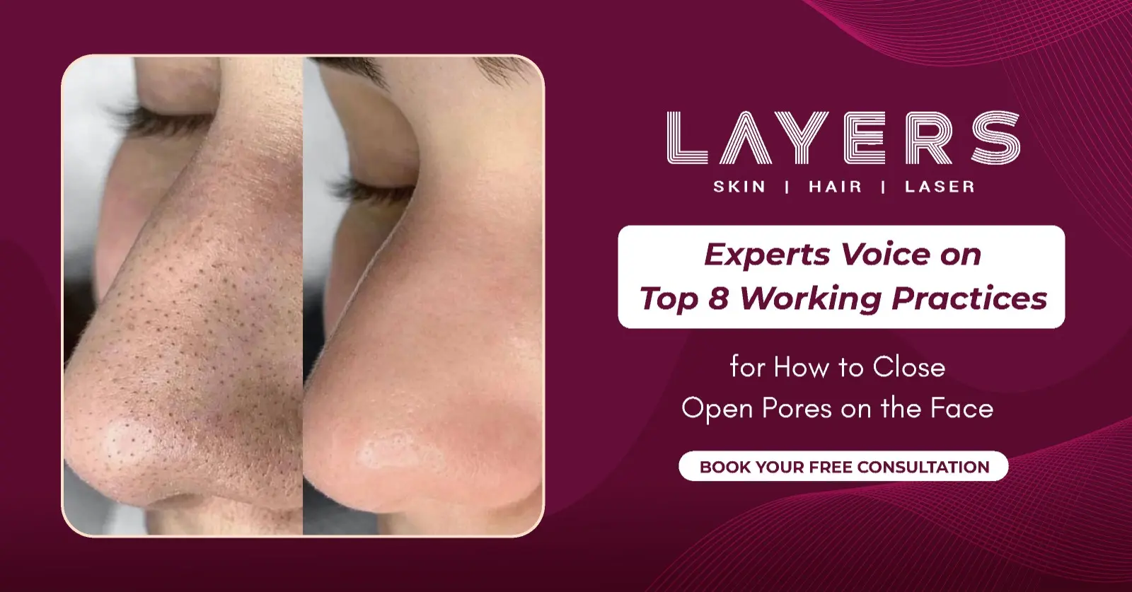 How to Close Open Pores on Face Expert Skin Tips