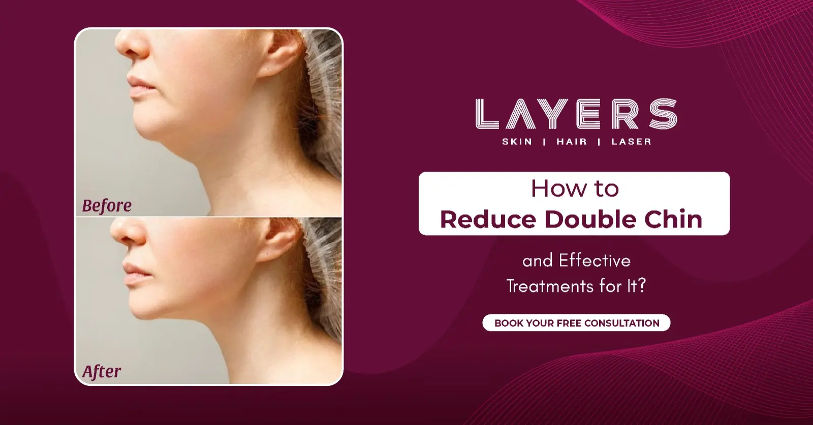 How to Reduce Double Chin