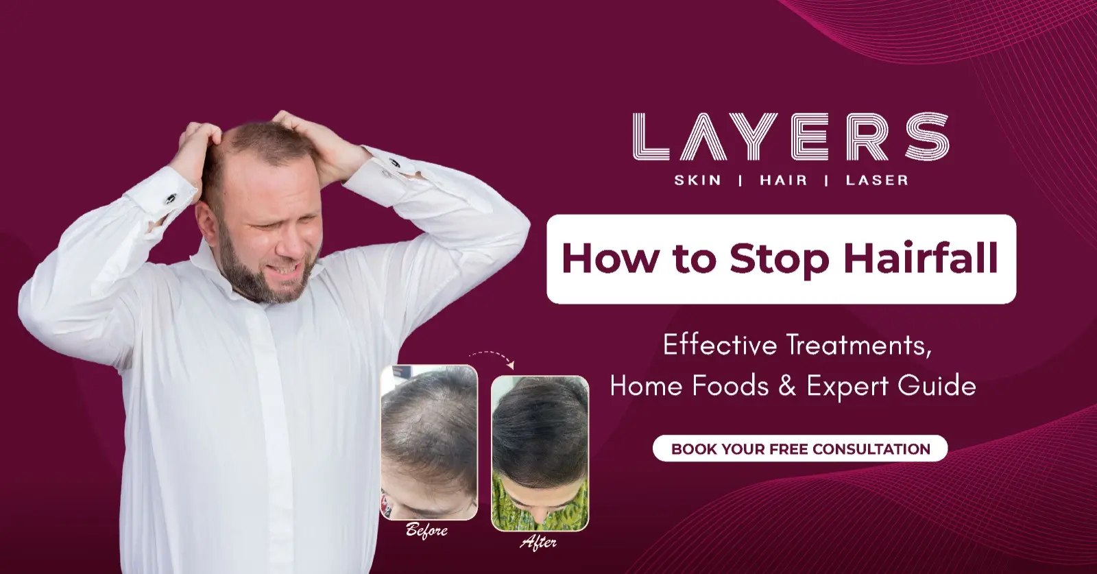 How to Stop Hair Fall Effective Treatments, Home Foods & Expert Guide