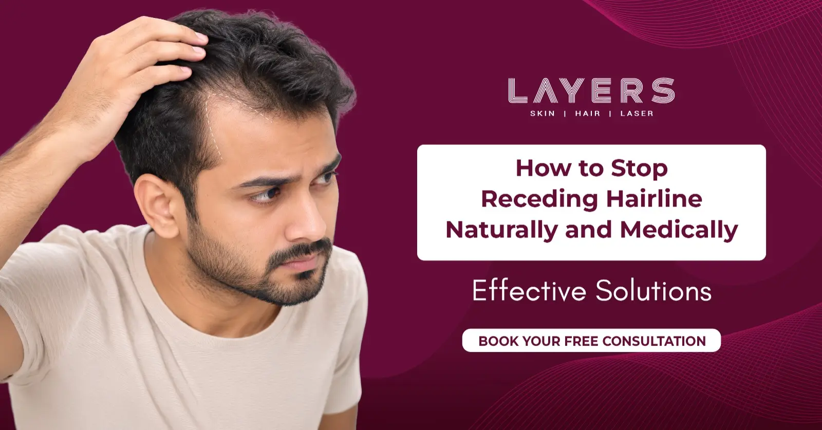 How to Stop Receding Hairline Naturally and Medically