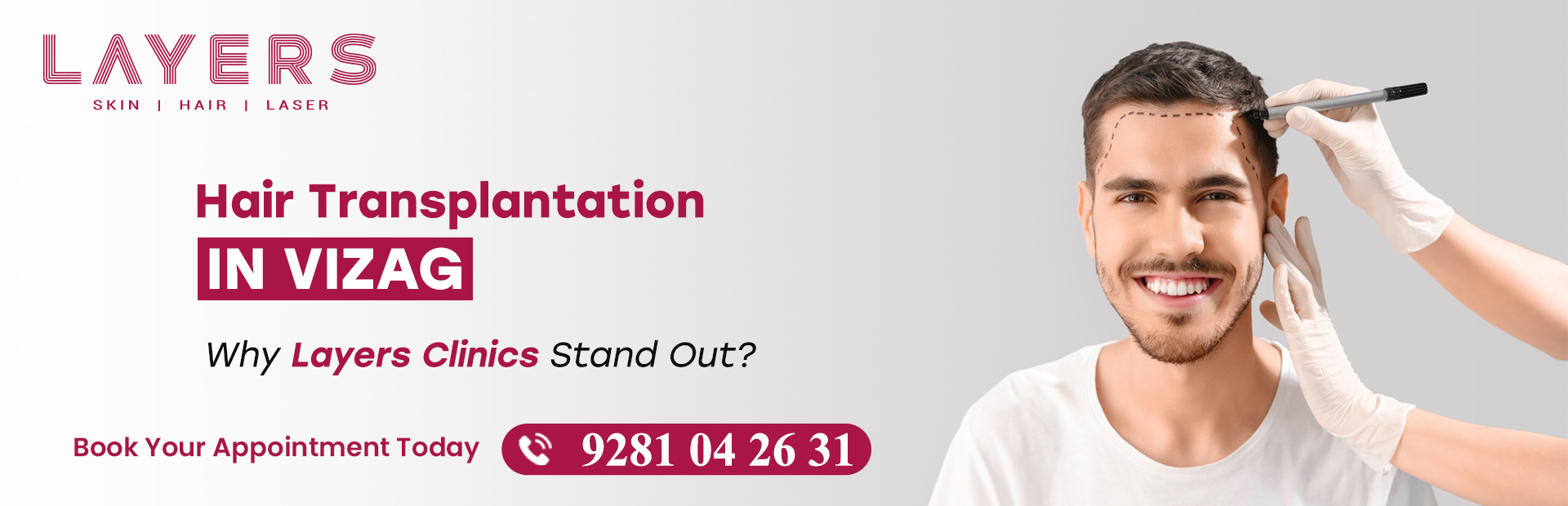 Hair Transplant in Vizag