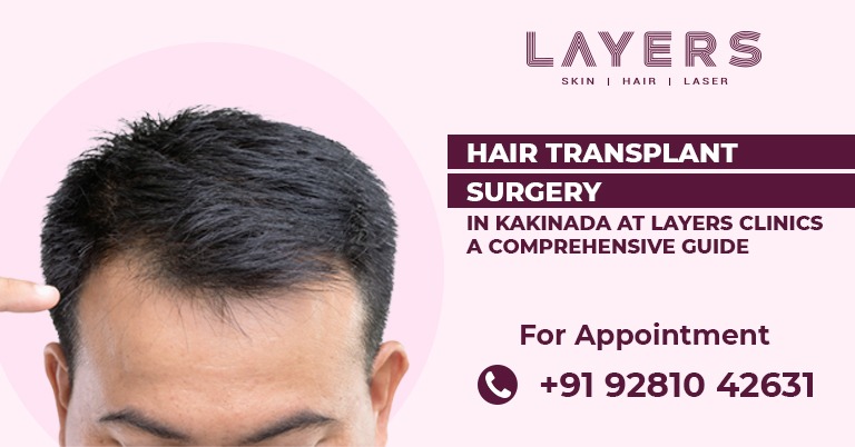 Best Hair Transplant Surgery in Kakinada