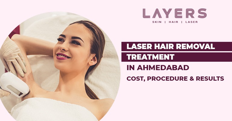 Laser hair removal treatment in ahmedabad