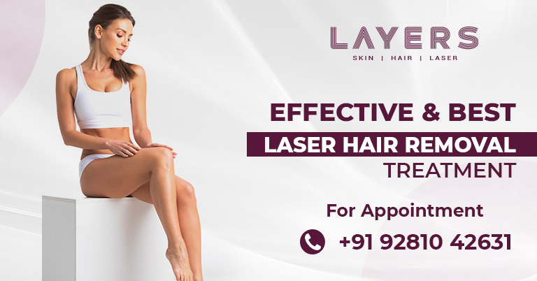 Laser Hair Removal Treatment