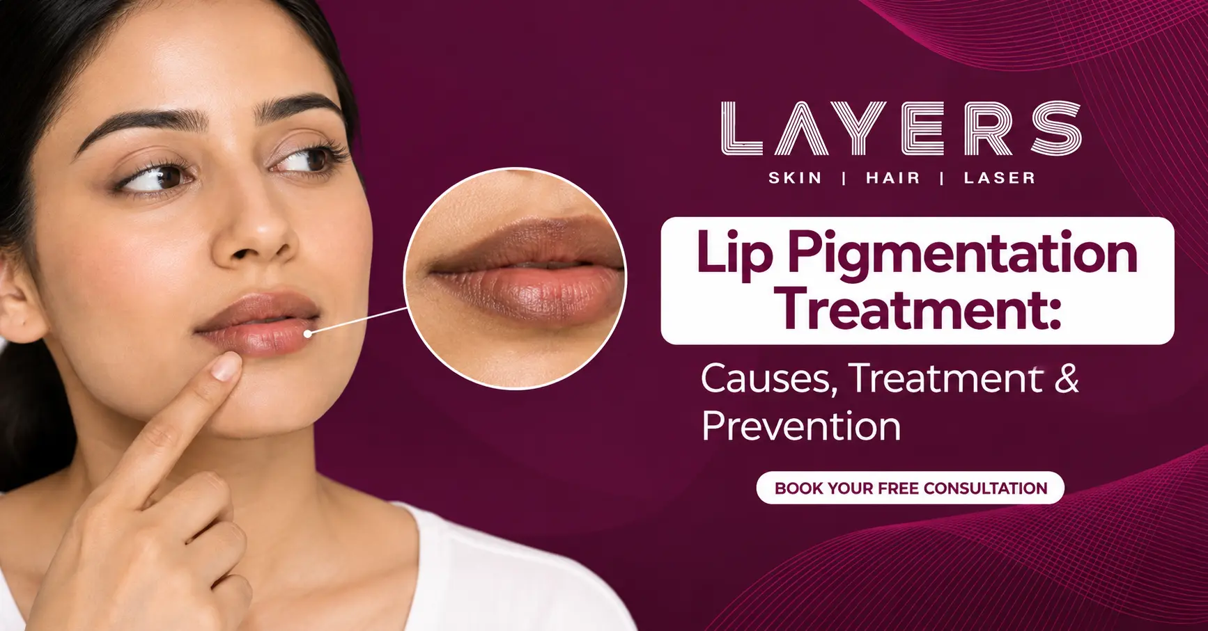 Lip Pigmentation Treatment Causes, Treatment & Prevention