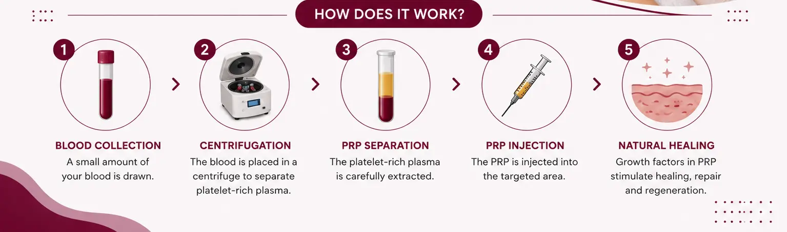 PRP therapy for hair loss treatment how it works
