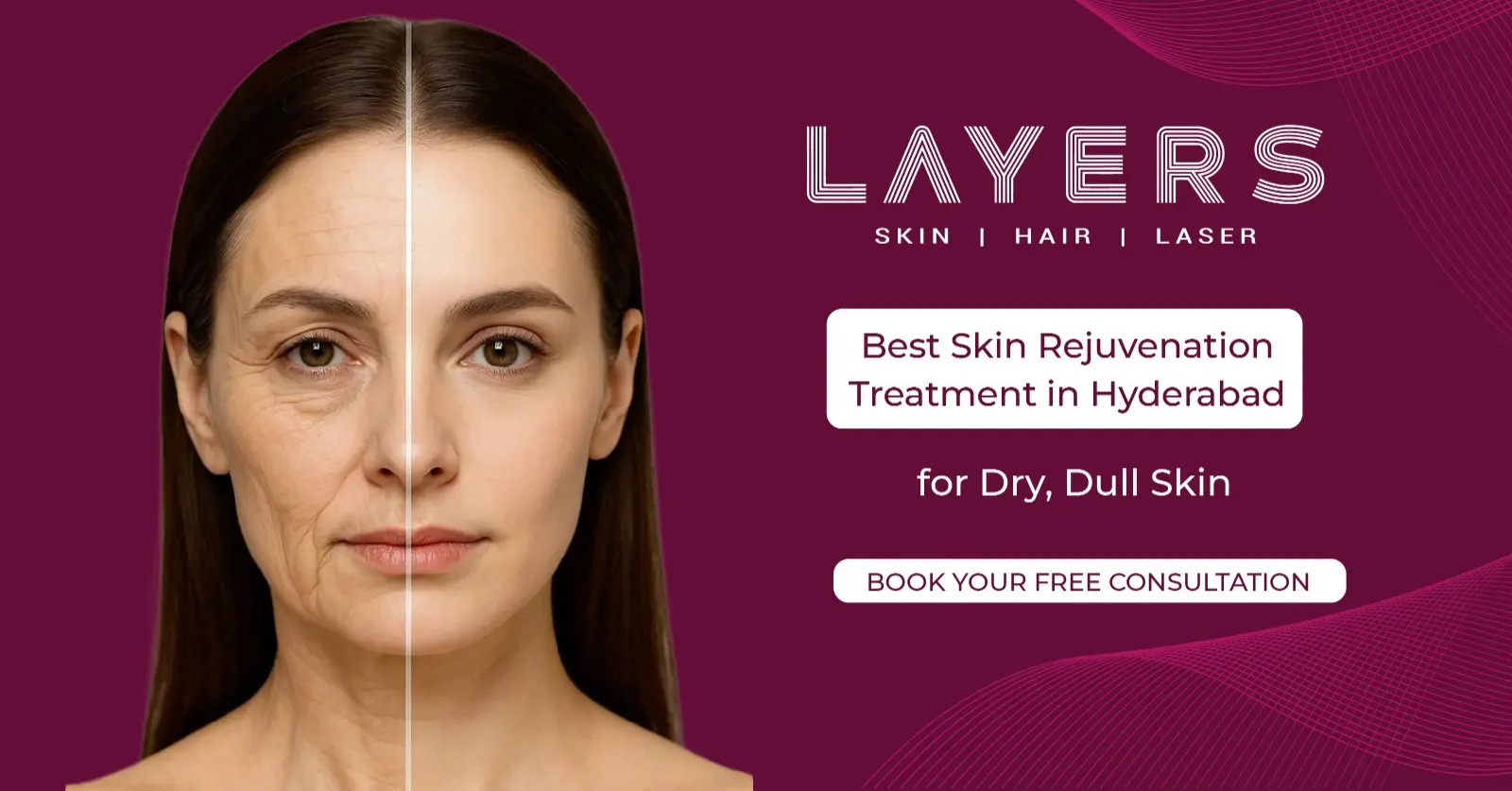 Skin Rejuvenation Treatment in Hyderabad