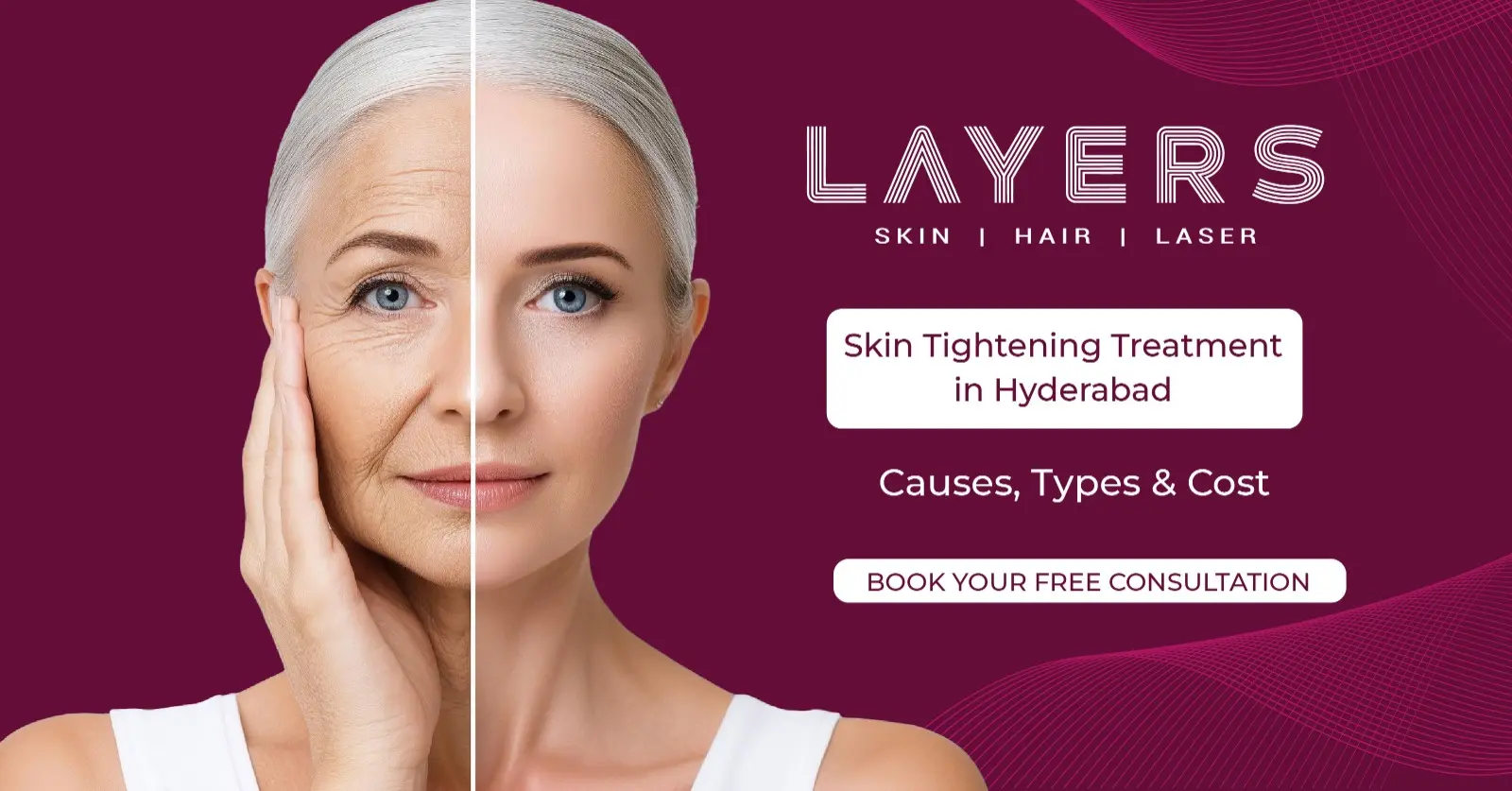 Skin Tightening Treatment in Hyderabad
