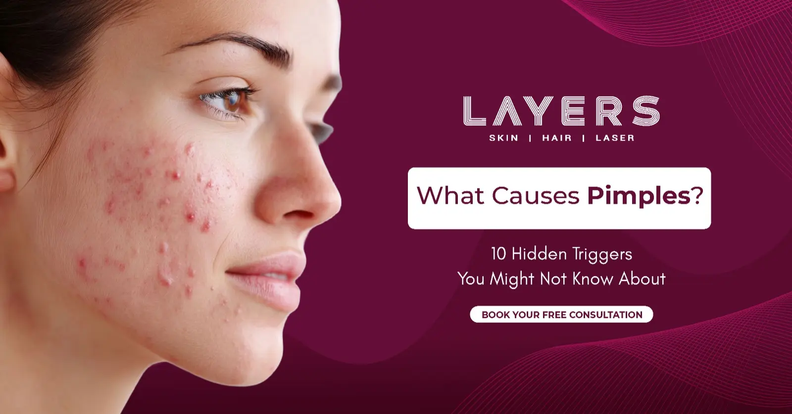 What Causes Pimples