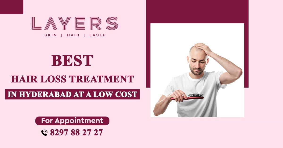 Hair Loss Treatment