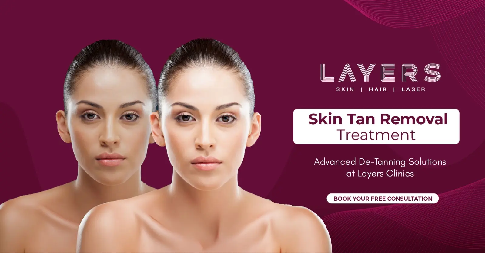 Skin Tan Removal Treatment – Advanced De-Tanning Solutions