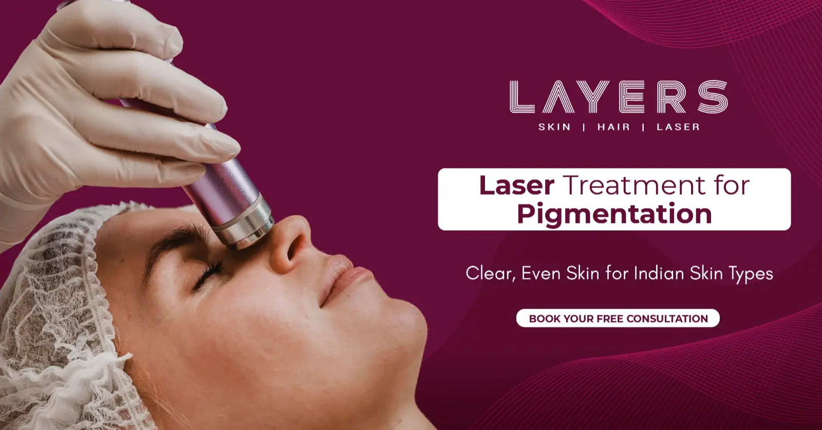 Laser Treatment for Pigmentation