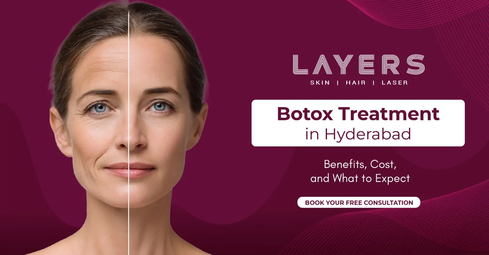 Botox Treatment in Hyderabad