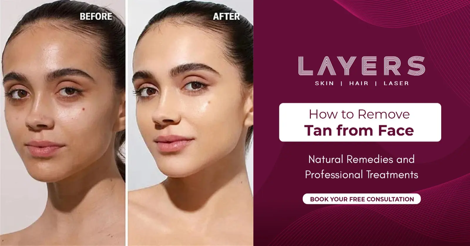 How to Remove Tan from Face