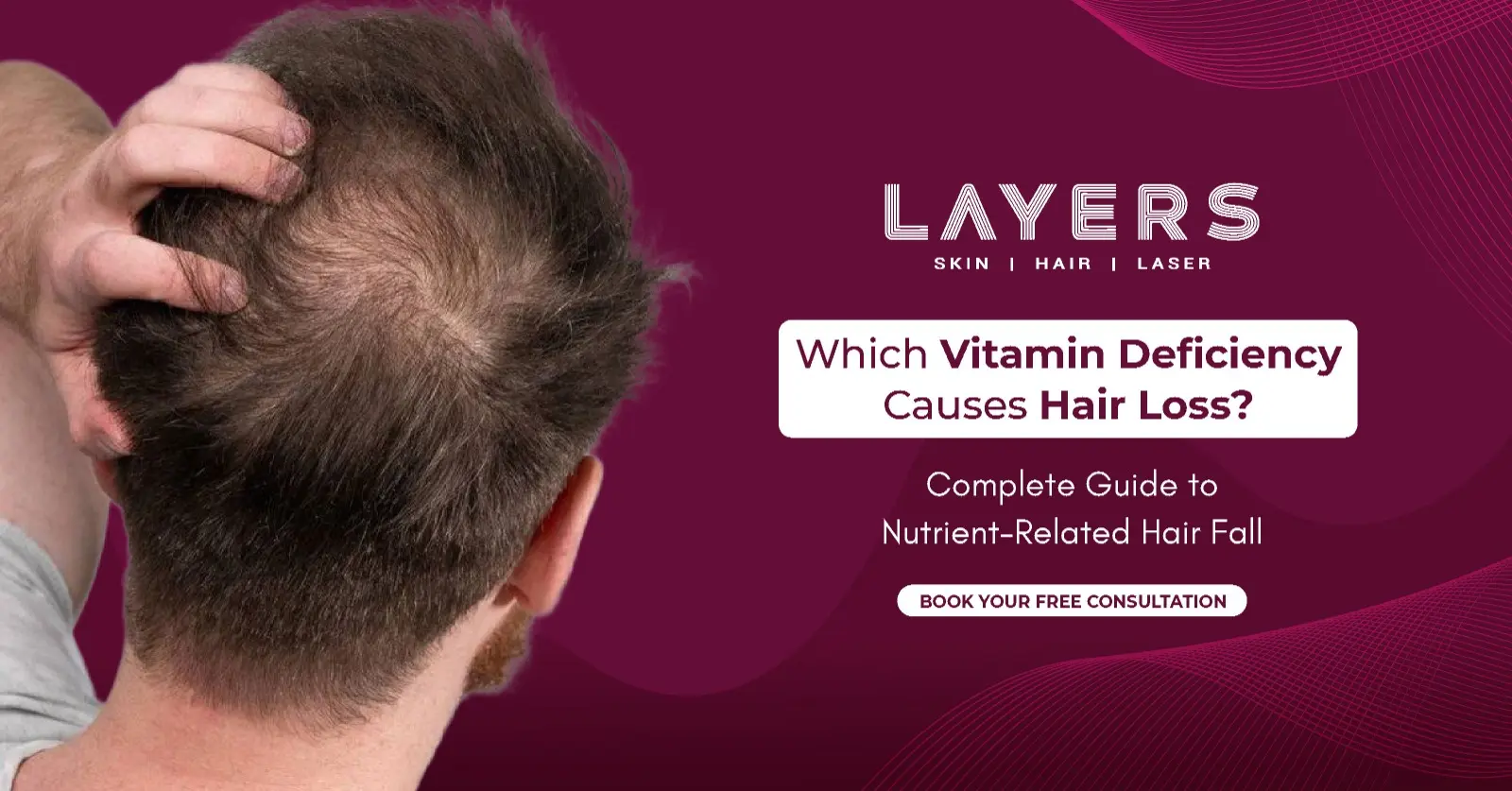 Which Vitamin Deficiency Causes Hair Loss